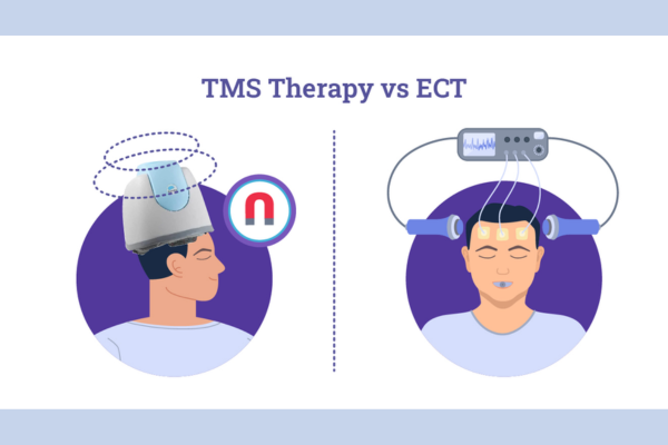 TMS vs. ECT What are the Differences